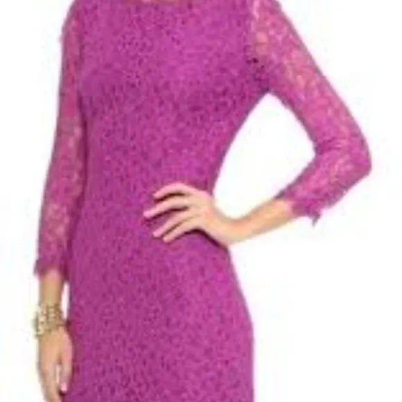 DIANE VON FUSTENBERG LACE DRESS